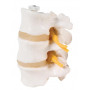 OSTEOLOGIE HUMAINE 3 VERTÈBRES LOMBAIRES