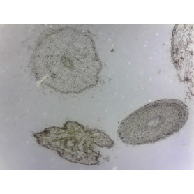 PRÉPARATION MICROSCOPIQUE MITOSE RACINE JACINTHE CL (HEMATOXYLINE)