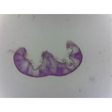 PRÉPARATION MICROSCOPIQUE POILS SECRETEURS ET TECTEURS (FEUILLE ROMARIN CT)