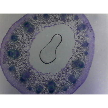 PRÉPARATION MICROSCOPIQUE TIGE DE DICOTYLEDONE PRIMAIRE (RENONCULE)