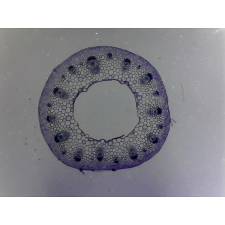 PRÉPARATION MICROSCOPIQUE TIGE DE RENONCULE