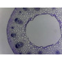 PRÉPARATION MICROSCOPIQUE TIGE DE RENONCULE