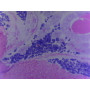 PRÉPARATION MICROSCOPIQUE ARENICOLE