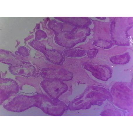 PRÉPARATION MICROSCOPIQUE OURSIN GLANDE MÂLE CT