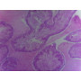 PRÉPARATION MICROSCOPIQUE OURSIN GLANDE MÂLE CT