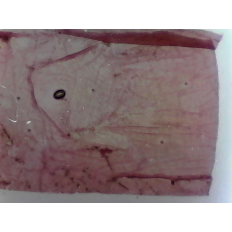 PRÉPARATION MICROSCOPIQUE STIGMATES