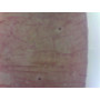 PRÉPARATION MICROSCOPIQUE STIGMATES
