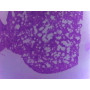 PRÉPARATION MICROSCOPIQUE POUMON CT