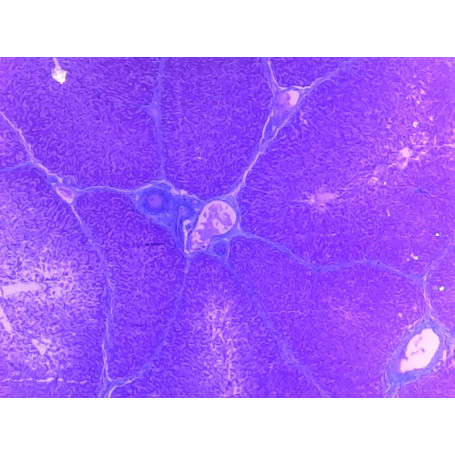 PRÉPARATION MICROSCOPIQUE FOIE PORC CT