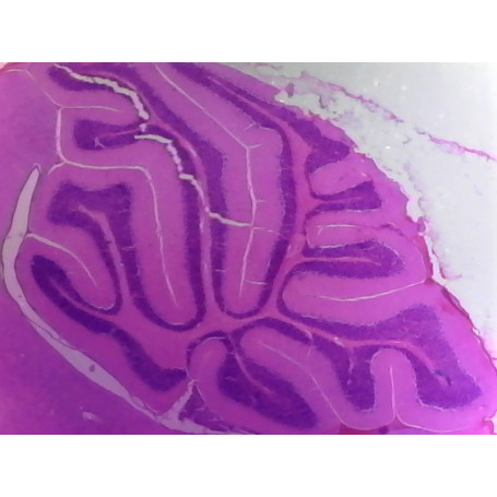 PRÉPARATION MICROSCOPIQUE ENCEPHALE CL