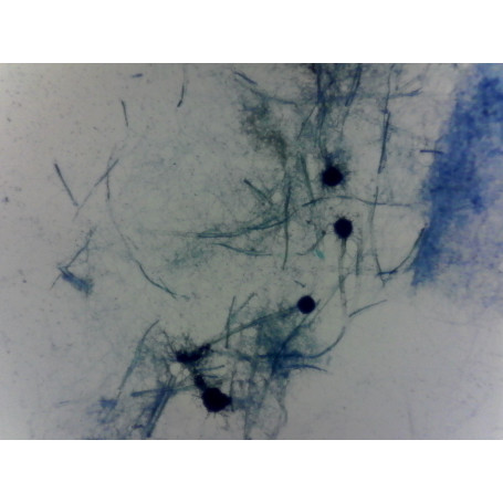 PRÉPARATION MICROSCOPIQUE ASPERGILLUS