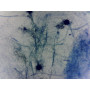 PRÉPARATION MICROSCOPIQUE ASPERGILLUS
