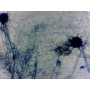 PRÉPARATION MICROSCOPIQUE ASPERGILLUS